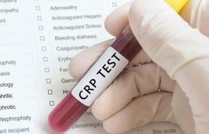آزمایش خون CRP