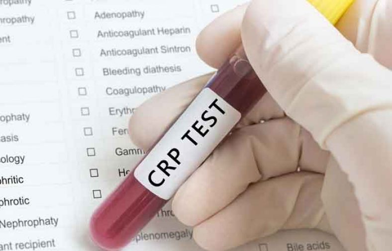 آزمایش خون CRP