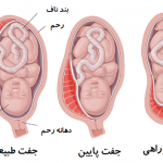 استراحت برای جفت پایین