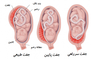 استراحت برای جفت پایین
