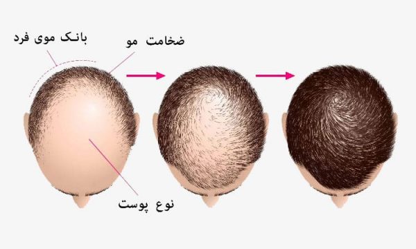 بانک مو چیست