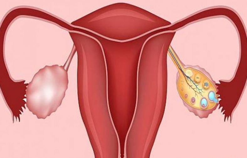 بهترین قرص‌ ها برای تنبلی تخمدان