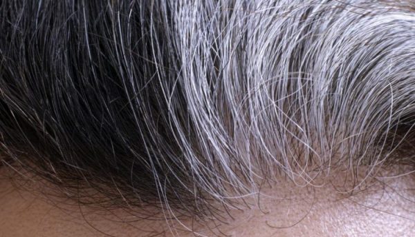 درمان سفیدی مو با روغن زیتون