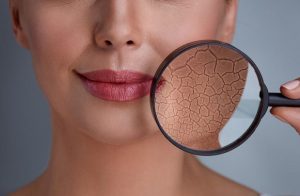 از بین بردن خط خنده