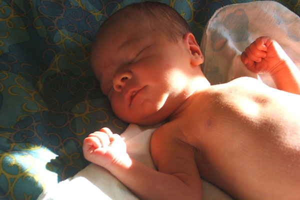 درمان خانگی زردی نوزاد ده روزه