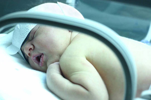 روش های درمان خانگی زردی نوزاد 