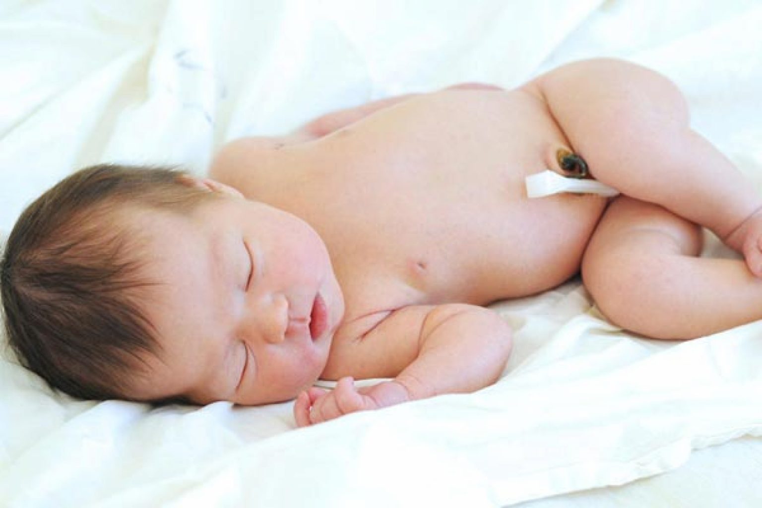 Половые органы новорожденного мальчика. Омфалит новорожденных омфалит. Пупочная ранка у новорожденного. Омфалит у новорожденных фото.