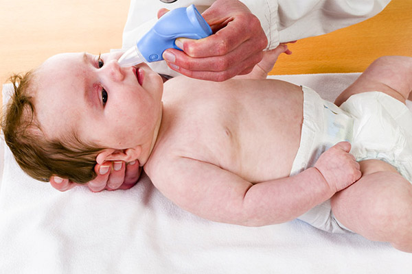 راه های درمان آبریزش بینی نوزاد