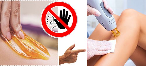 وکس کردن قبل از لیزر ممنوع
