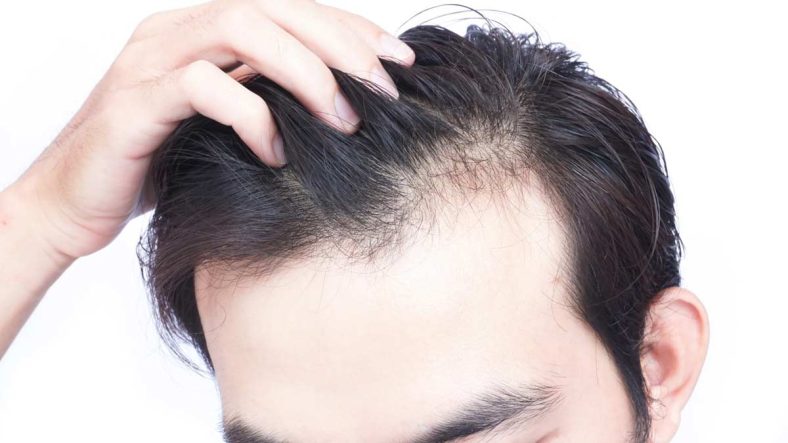 میزان طبیعی ریزش مو در
