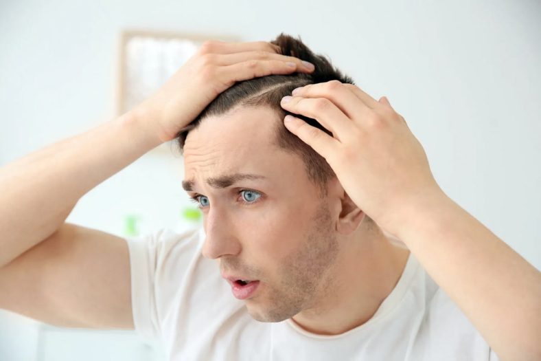 جلوگیری از ریزش مو