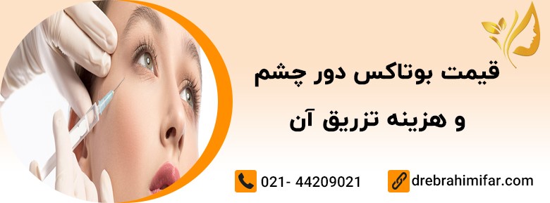 بوتاکس دور چشم