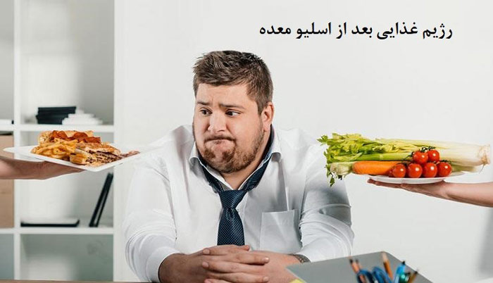 تغذیه بعد از اسلیو معده