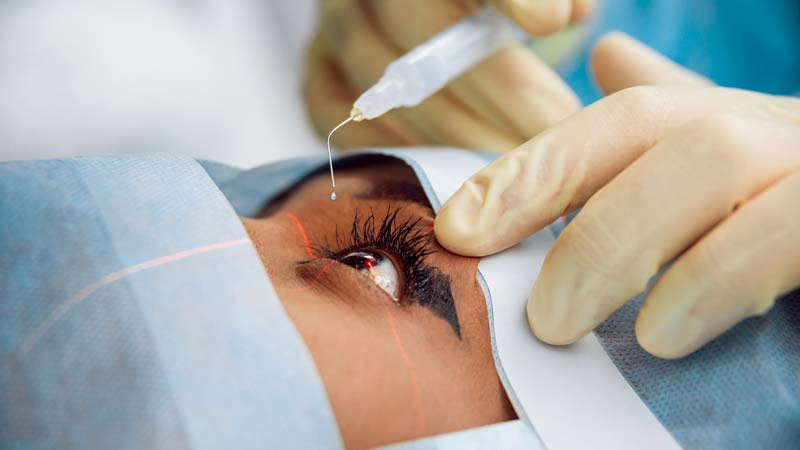 بهترین عمل جراحی چشم