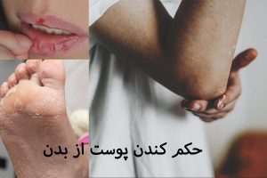 حکم کندن پوست از بدن