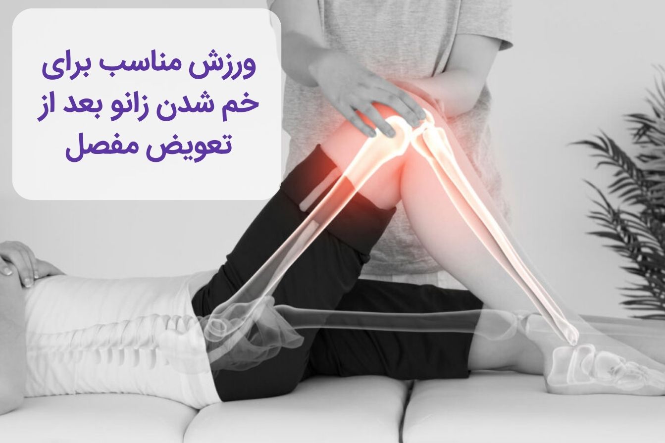 ورزش برای خم شدن زانو بعد از عمل مفصل