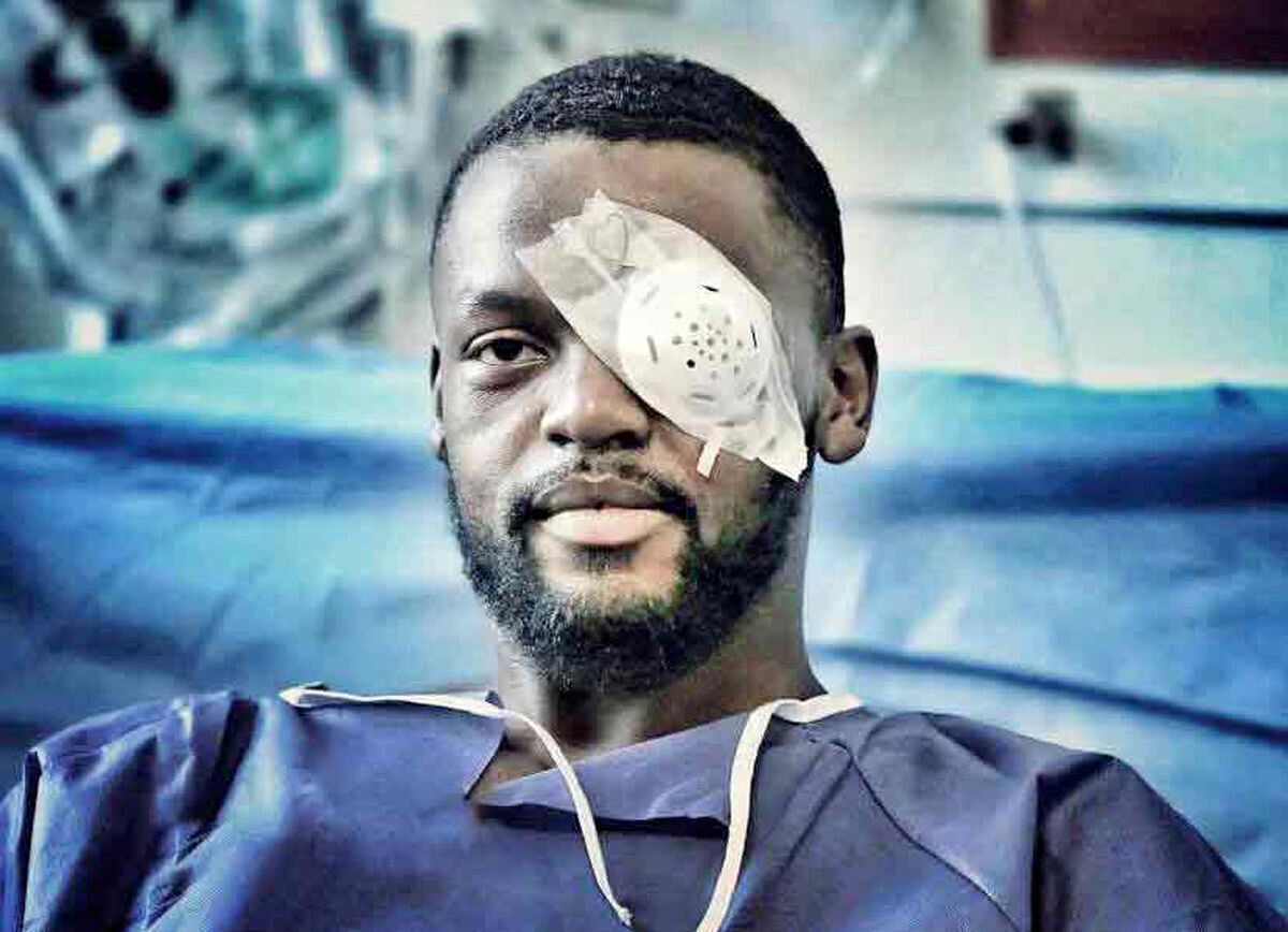 چشم چپ کوین یامگا