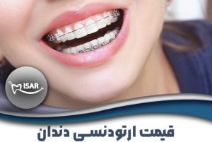 همه‌چیز درباره قیمت ارتودنسی دندان: راهنمای جامع و کامل