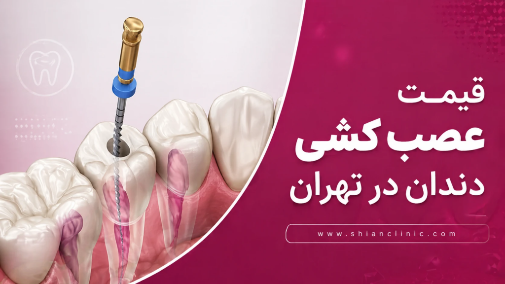 قیمت پرکردن دندان با عصب کشی در سال ۱۴۰۵ + جدول هزینه‌ها