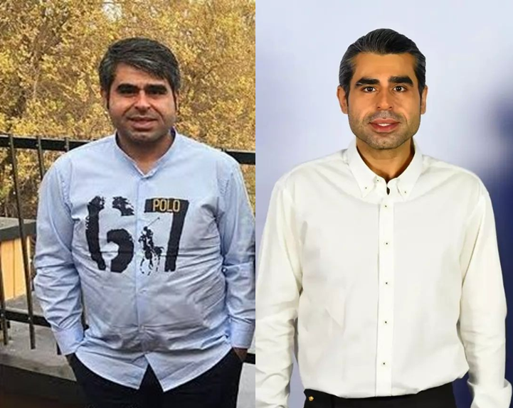 قبل و بعد امیر نوری