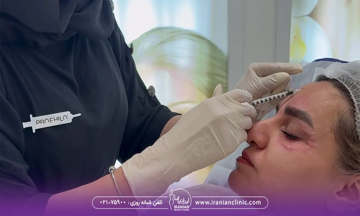 کلینیک ایرانیان؛ انتخابی مطمئن برای تزریق بوتاکس در تهران