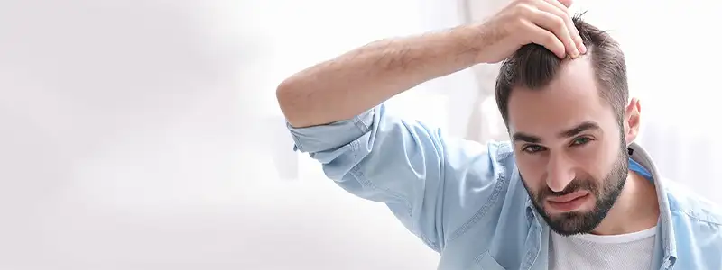 بهترین کاشت مو در ایلام