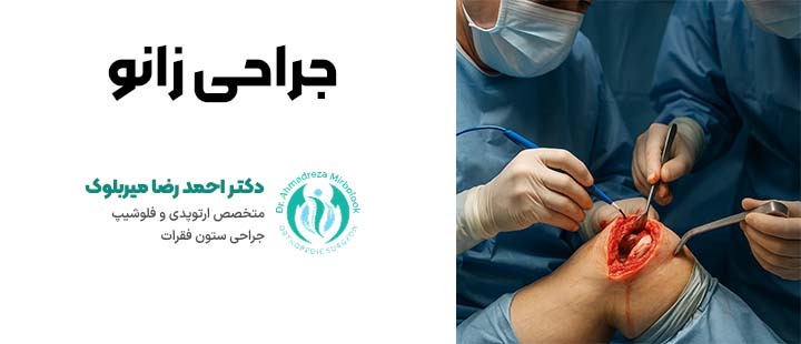 جراحی زانو توسط دکتر میربلوک