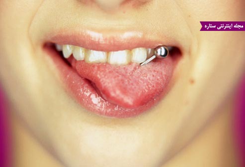 سوراخ کردن زبان - پیرسینگ زبان - نصب پیرسینگ و سلامت دندان ها