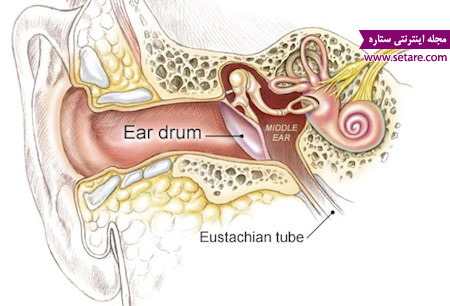 عفونت گوش میانی – درمان عفونت گوش – علت عفونت گوش – گوش درد – عوارض عفونت گوش – علائم عفونت گوش