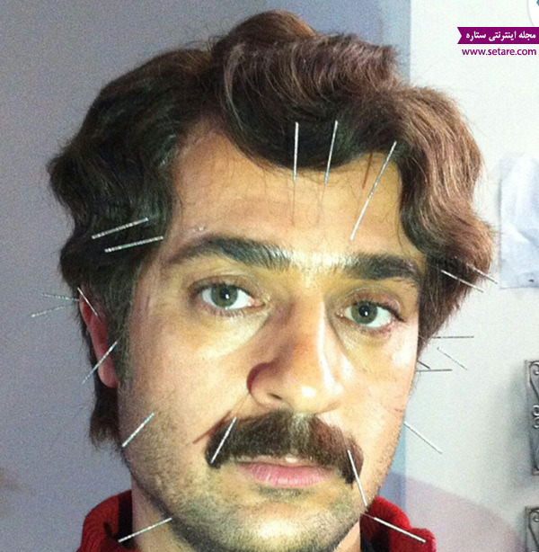 آلبوم عکس و بیوگرافی احمد مهرانفر، بازیگر نقش ارسطو، طب سوزنی، طب سوزنی احمد مهرانفر آلبوم عکس و بیوگرافی احمد مهرانفر، بازیگر نقش ارسطو، طب سوزنی، طب سوزنی احمد مهرانفر