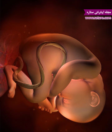 عکس جنین در مسیر واژن