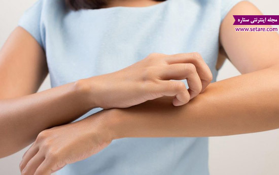 روش درمان حساسیت پوستی - درمان درماتیت - درماتیت چیست - آلرژی های پوستی