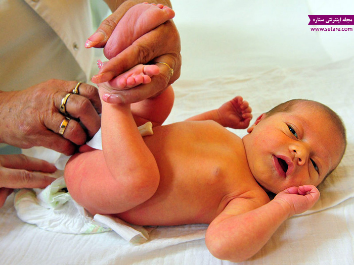 راه های درمان زردی نوزادان + علت، علائم و راه های تشخیص آن