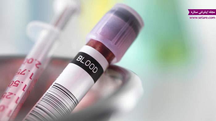 تفسیر آزمایش خون - جواب آزمایش خون - آزمایش خون cbc