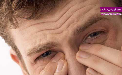 تقویت چشم ضعیف - خوراکی های مفید برای تقویت چشم و بینایی