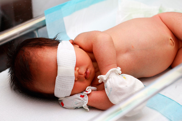 زردی نوزاد چقدر طول می‌کشد؟ - فتوتراپی برای درمان زردی نوزاد