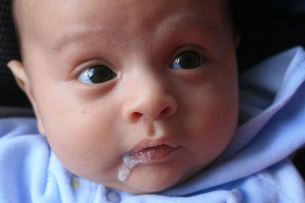 بالا آوردن شیر نوزاد و رفلاکس در نوزادان شیرخوار