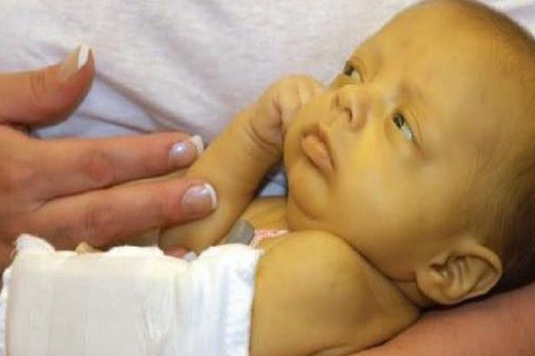 تغییرات رنگ پوست در نوزادان تازه متولد شده چگونه است؟