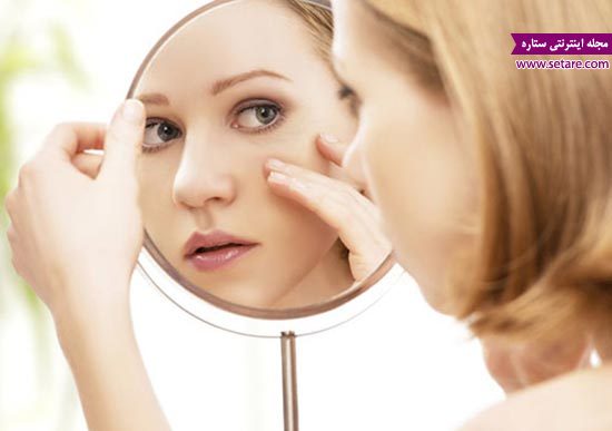 درمان خانگی لک های پوستی - انواع لکه های پوستی - درمان لک پوست