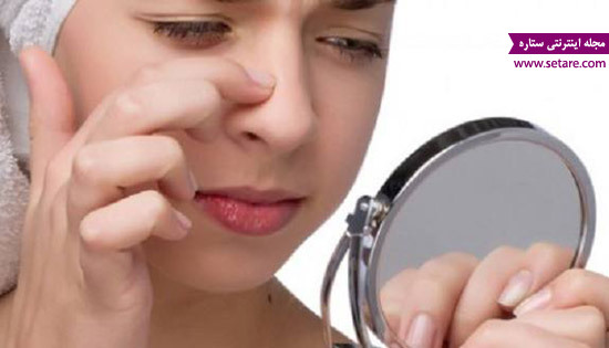 جوش سر سیاه - جوش های سر سیاه - جوش سر سیاه بینی جوش سر سیاه - جوش های سر سیاه - جوش سر سیاه بینی