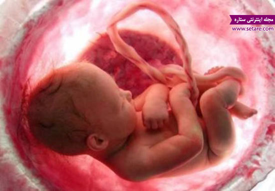 سقط جنین - برای سقط جنین - قرص سقط جنین