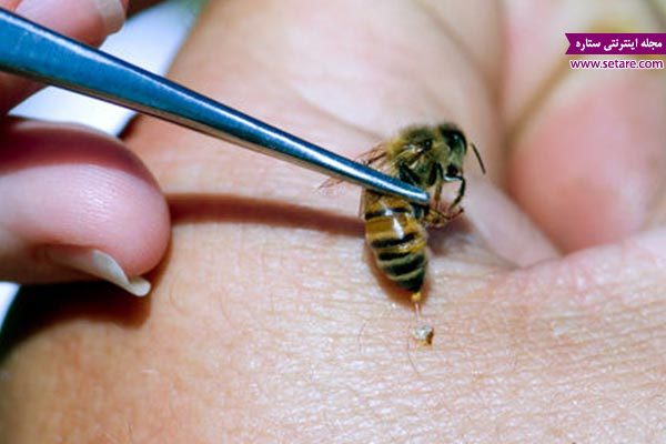درمان خانگی نیش زنبور، نیش حشرات، گیاهان دارویی، خارش، گزیدگی