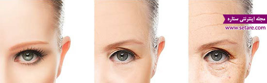 بوتاکس – لیزر درمانی – رفع چروک صورت