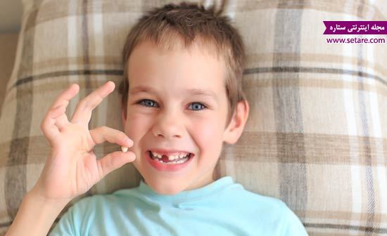 دندان شیری – پوسیدگی دندان – خدمان دندانپزشکی اطفال 
