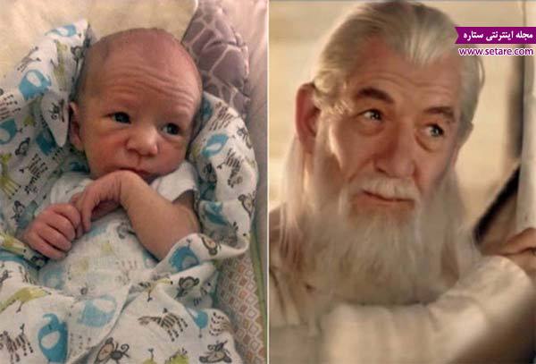  کودک  شبیه به گندالف (Gandalf)دارد.