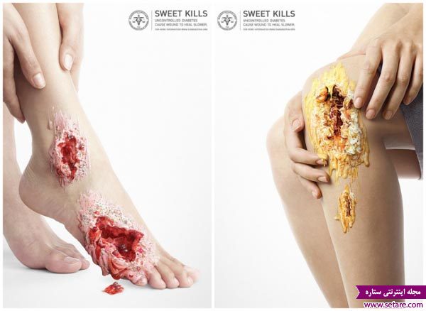 عکس پوستر تبلیغاتی  کشته شدن با شیرینی