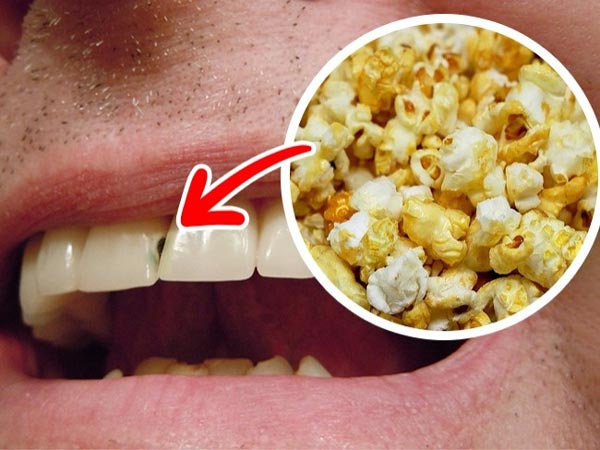عکس آسیب پاپ کورن روی دندان ها