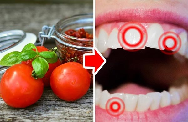 عکس آسیب گوجه فرنگی روی دندان ها