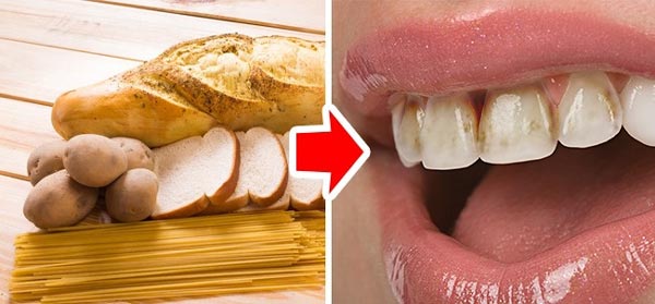 عکس آسیب نان، ماکارونی و سیب زمینی روی دندان ها