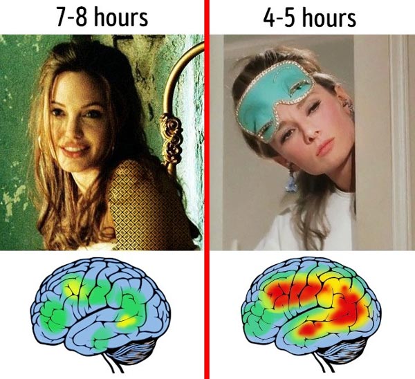 عکس تاثیر کمبود خواب مزمن بر عملکرد مغز
